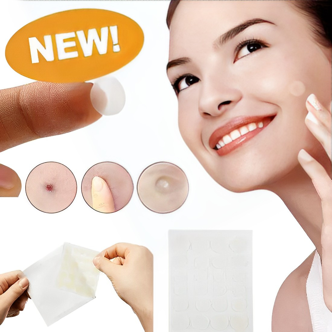 4213103902_plastyr-ot-pryschej Пластырь от прыщей Acne Patch - Зображення 1